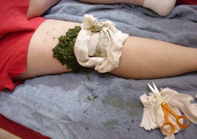 compresse pour l'arthrose de l'articulation du genou