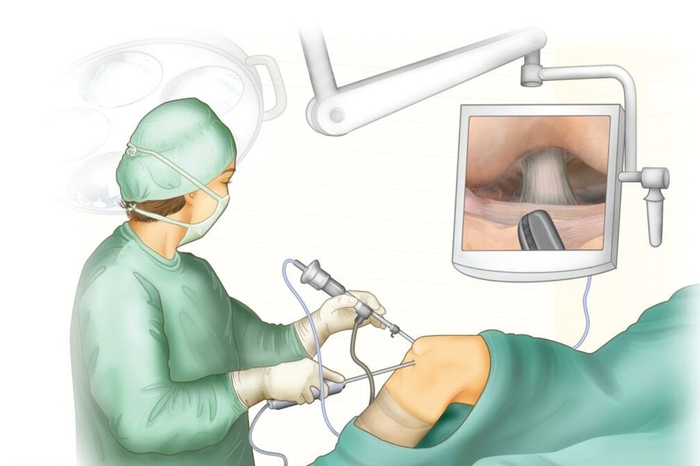 Chirurgie du genou