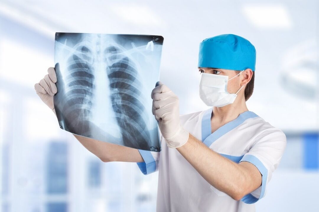 Radiographie pulmonaire avec ostéochondrose